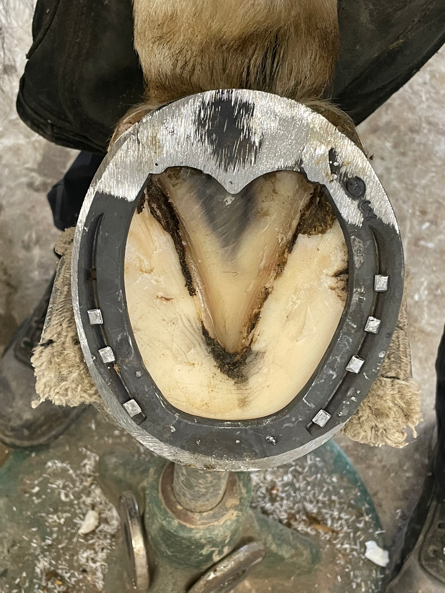 Ferrage orthopédique